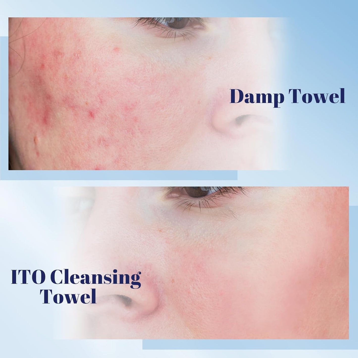 ITO Disposable Face Towel, Ultra-Soft 1-Second Quick-Dry Face Towels, Gentle for Sensitive Dry Oily Skin, Facial Towels for Daily Cleansing Makeup Removal (210 Count (3 Packs))